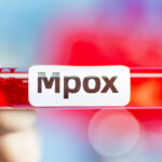epidemia de mpox este in continuare o urgenta de sanatate publica a anuntat oms 6740e791b2a7d