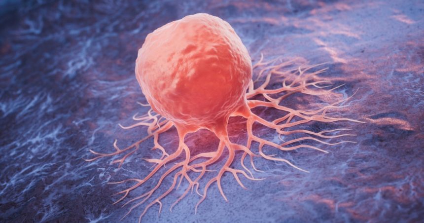 numarul deceselor provocate de cancer la nivel mondial se va dubla pana in 2050 potrivit unui studiu 672b6aee493d8