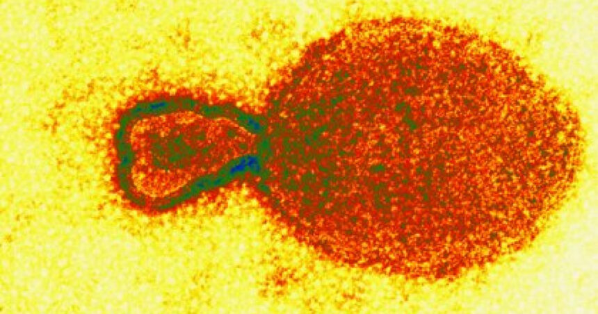Incident grav de biosecuritate: sute de mostre de virusuri periculoase au dispărut dintr-un laborator de cercetare 1 grav incident de biosecuritate sute de mostre de virusuri periculoase au disparut dintr un laborator de cercetare 6758aa7a7bc83