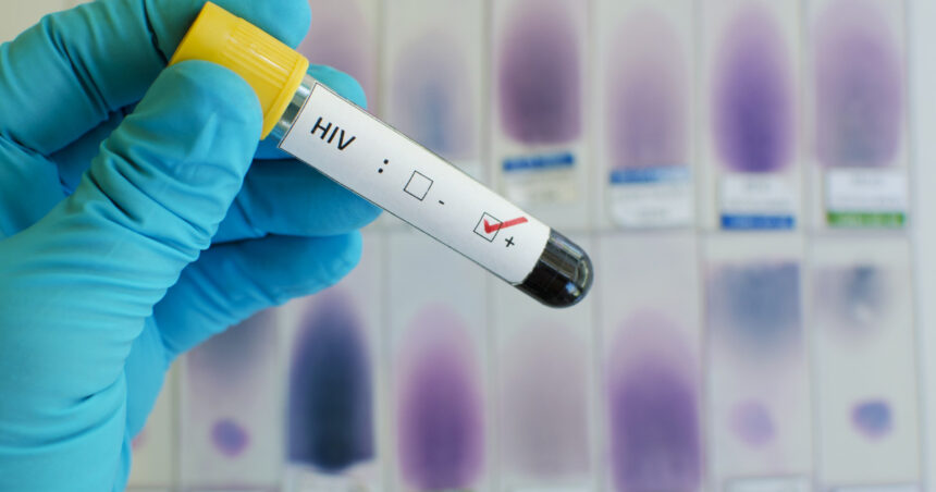 revista science a votat cea mai importanta descoperire stiintifica in 2024 un medicament impotriva infectarii cu hiv 675c0ae260340