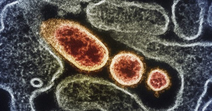 uniunea europeana urmareste indeaproape o noua boala misterioasa care a facut zeci de morti intr o tara africana 67572700362b9