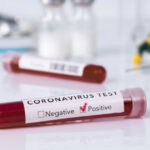 cia este mai probabil ca pandemia de covid 19 a provenit dintr un laborator si nu din natura 67963ddd09d07