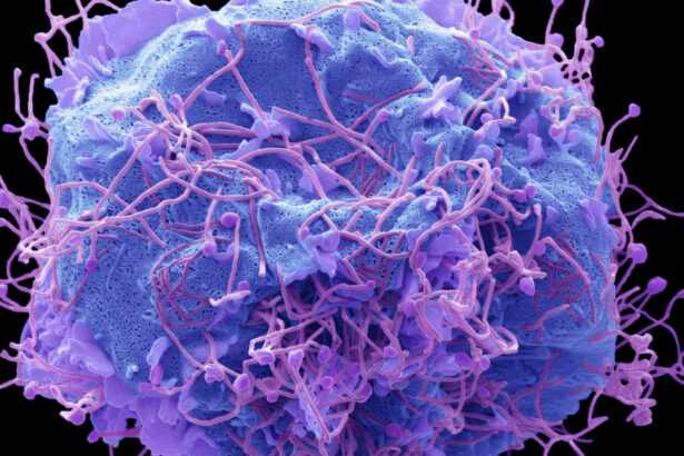 dupa covid un nou virus provoaca ingrijorare in china ce este hmpv si care sunt simptomele 677c235326af7