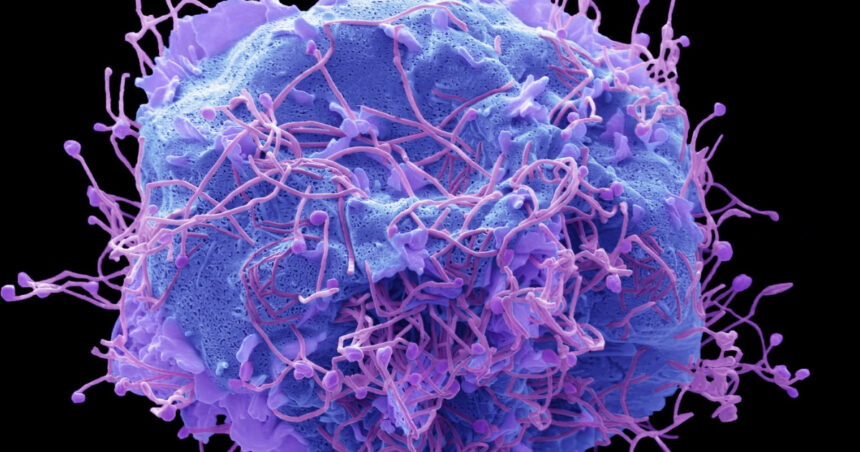 dupa covid un nou virus provoaca ingrijorare in china ce este hmpv si care sunt simptomele 677c235326af7