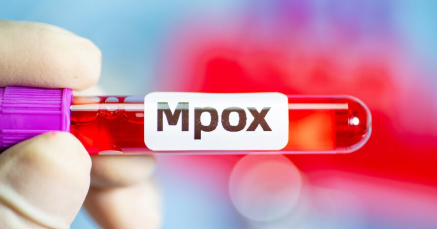 primul caz de imbolnavire cu noua varianta mpox detectat in franta 677ce842cc63b