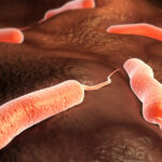 epidemie grava de holera in angola peste 4000 de persoane s au imbolnavit dintre care 150 au murit 67b4a92aee7e2
