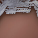 nu am mai vazut asa ceva o boala tropicala rara aparuta dupa inundatiile din nord estul australiei se raspandeste rapid 67bee0a39fbf4