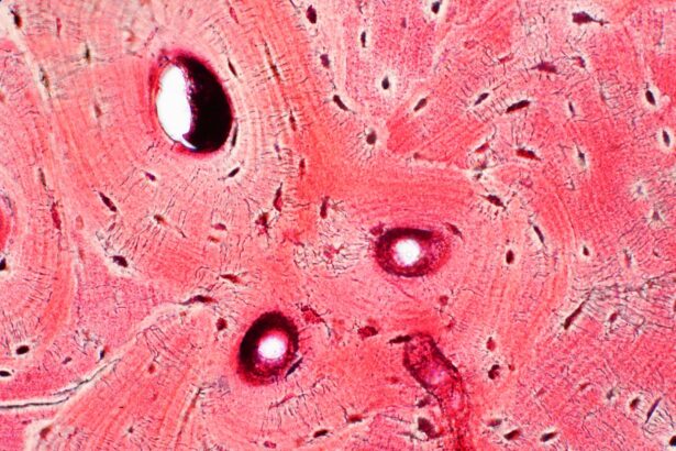 uneori amigdalele reapar dupa ce au fost scoase care alte organe pot face la fel 67a23ca81bc8d