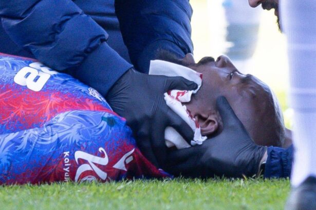 galerie foto criminalul de la millwall risca o pedeapsa colosala victima lui a avut nevoie de 25 de puncte de sutura 67c844e740b20