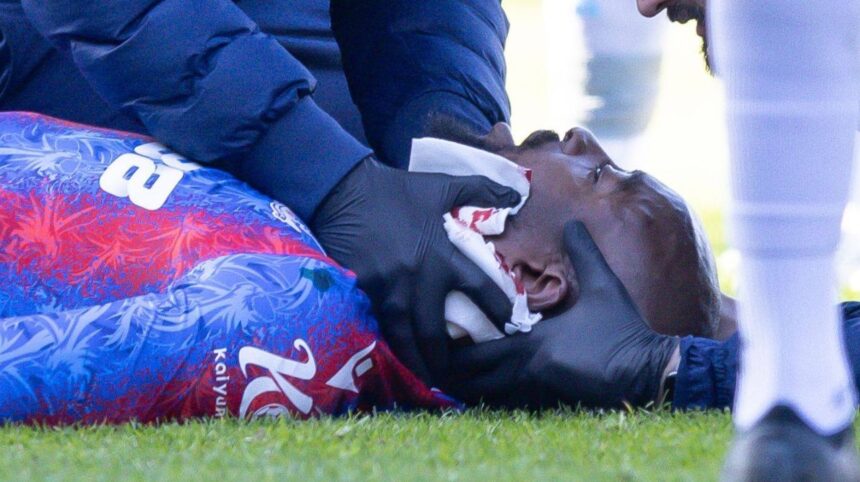 galerie foto criminalul de la millwall risca o pedeapsa colosala victima lui a avut nevoie de 25 de puncte de sutura 67c844e740b20