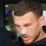 galerie foto cum si a facut aparitia edin dzeko la o zi dupa ce mihai popescu i a spart nasul situatia nu e promitatoare 67ded8a9190d1
