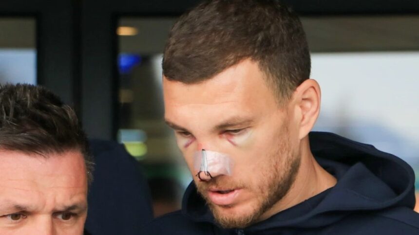 galerie foto cum si a facut aparitia edin dzeko la o zi dupa ce mihai popescu i a spart nasul situatia nu e promitatoare 67ded8a9190d1