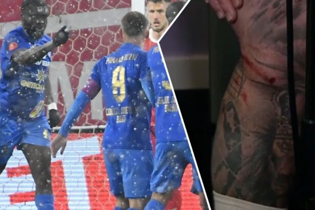 roland niczuly acuza dupa sepsi gloria buzau 1 2 era sa imi rupa genunchiul 67d88ae030f92