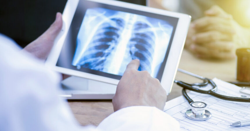 video pacientii nu isi recunosc simptomele tuberculoza face mii de victime in romania insa putini dintre bolnavi ajung la timp la medic 67e25239b2fea