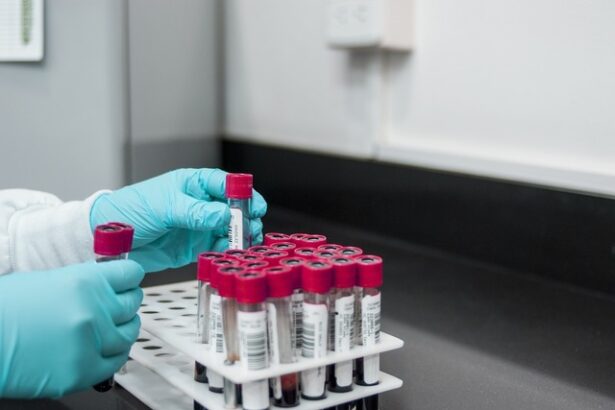 foto un nou test de sange cu ai poate detecta 12 dintre cele mai frecvente tipuri de cancer cu mult inainte de aparitia simptomelor 6809f5d20eaa2