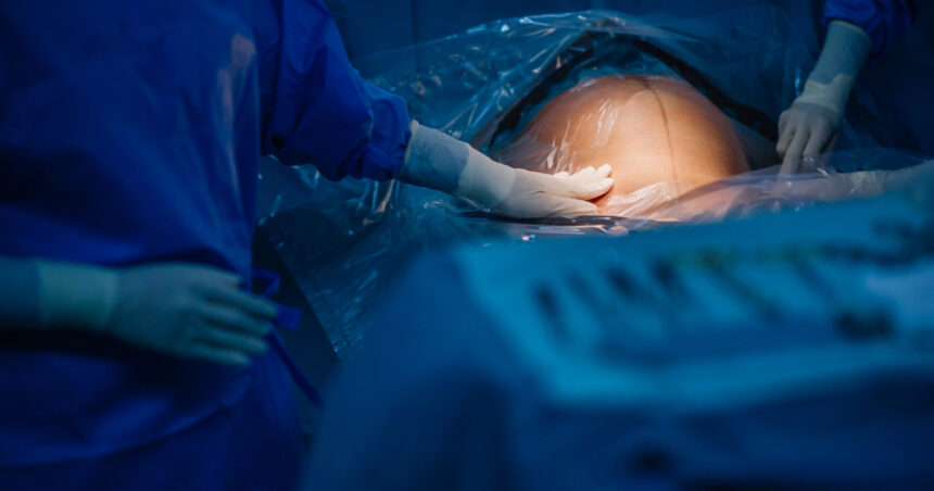 turcia interzice nasterile prin cezariana in clinici private regimul erdogan vorbeste despre nevoia de crestere a natalitatii 6807bb2ce6271