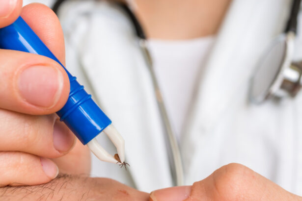 cum scoti corect o capusa si cand trebuie sa mergi la medic avertismentul specialistilor nu se folosesc substante pe piele 68368b8eeda7a