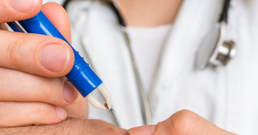 cum scoti corect o capusa si cand trebuie sa mergi la medic avertismentul specialistilor nu se folosesc substante pe piele 68368b8eeda7a