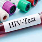 cercetatorii australieni uluiti de efectele unui nou tratament contra hiv descoperirea care ar putea duce la eradicarea virusului 6845131d390bc