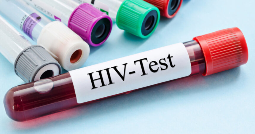 cercetatorii australieni uluiti de efectele unui nou tratament contra hiv descoperirea care ar putea duce la eradicarea virusului 6845131d390bc