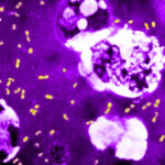 cum a evoluat cea mai letala bacterie din toate timpurile ca sa continue sa omoare milioane de oameni si sa supravietuiasca pana astazi 683e837ebf0ef