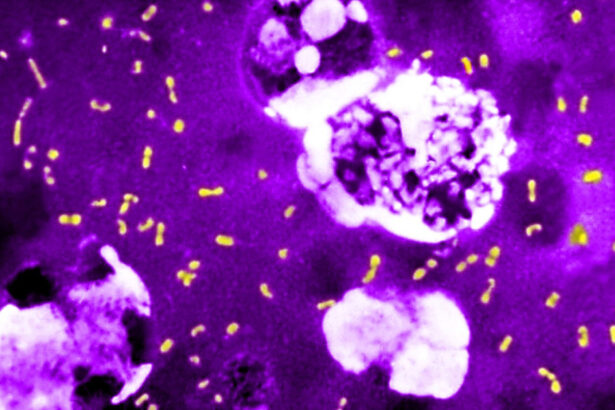 cum a evoluat cea mai letala bacterie din toate timpurile ca sa continue sa omoare milioane de oameni si sa supravietuiasca pana astazi 683e837ebf0ef