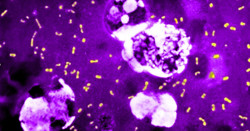 cum a evoluat cea mai letala bacterie din toate timpurile ca sa continue sa omoare milioane de oameni si sa supravietuiasca pana astazi 683e837ebf0ef