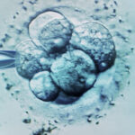 ceasul biologic al barbatilor legat de avorturile spontane in cazul fertilizarii in vitro 686c10a59c5dc