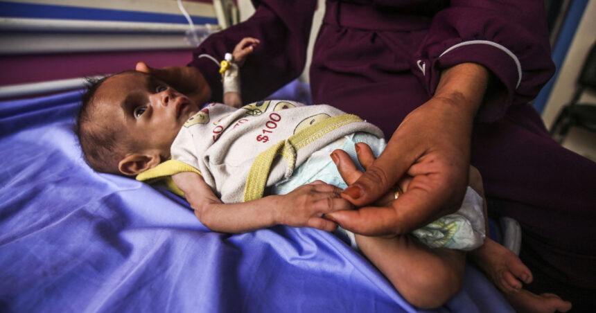 galerie foto infometare in masa numarul copiilor subnutriti din gaza cu varste sub 5 ani s a triplat in ultimele doua saptamani 6883eefa5d91f
