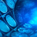 o singura scanare cerebrala poate dezvalui cat de repede imbatranesti 6867e867a77bb