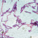 suspiciune de antrax la doua persoane internate la institutul national de boli infectioase matei bals din bucuresti 686e8fd1c4e15