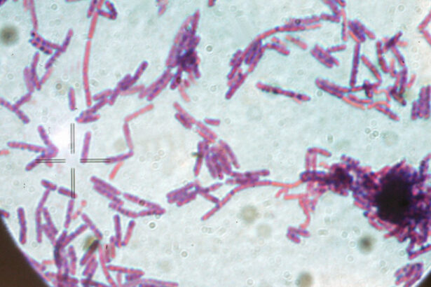 suspiciune de antrax la doua persoane internate la institutul national de boli infectioase matei bals din bucuresti 686e8fd1c4e15