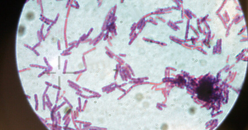 suspiciune de antrax la doua persoane internate la institutul national de boli infectioase matei bals din bucuresti 686e8fd1c4e15