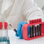 un test de sange ar putea detecta prezenta mutatiilor maligne cu 3 ani inainte de aparitia primelor simptome de cancer arata un studiu 6864b71fc69b9
