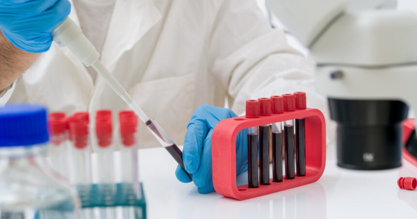 un test de sange ar putea detecta prezenta mutatiilor maligne cu 3 ani inainte de aparitia primelor simptome de cancer arata un studiu 6864b71fc69b9