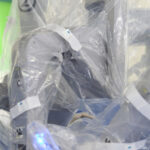 premiera in europa doua operatii la distanta pe pacienti aflati la 300 km 688e1f4321cb0