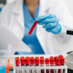 un test de sange ar putea depista cu precizie cancerul ovarian in stadii incipiente studiu 68ad79c936bd2