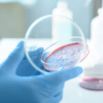 ce este serratia marcescens bacteria descoperita la spitalul sfanta maria din iasi unde au murit sase copii 68d69369f3c7d