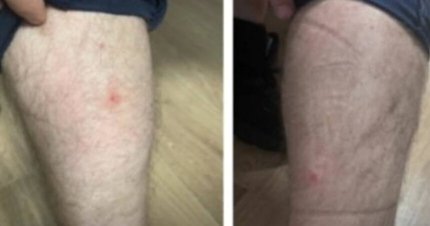 foto politisti muscati de plosnite in sediile politiei capitalei zece persoane au ajuns la urgenta ce masuri cere sindicatul europol 68b88087836a0