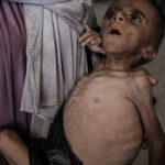 unicef peste 7 000 de copii cu varste sub 5 ani din gaza au fost inclusi in programe de recuperare din cauza malnutritiei acute 68bc75809e31a