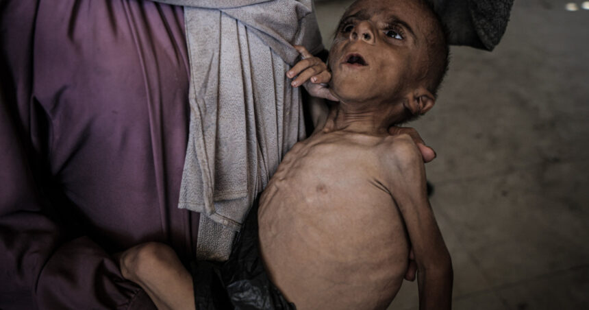 unicef peste 7 000 de copii cu varste sub 5 ani din gaza au fost inclusi in programe de recuperare din cauza malnutritiei acute 68bc75809e31a