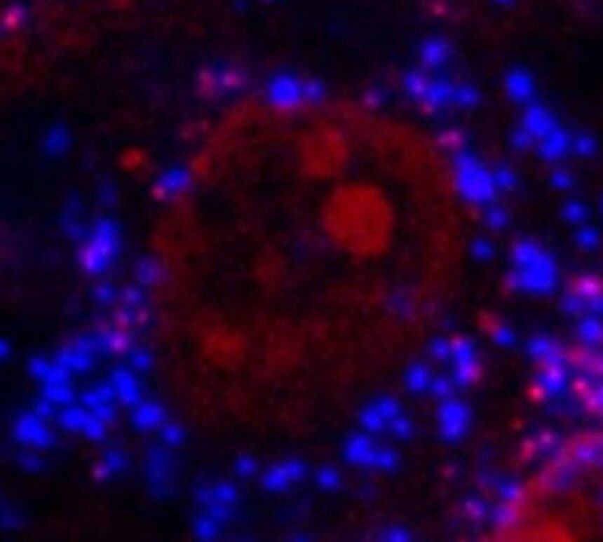 medicii au gasit dovezi ca microplasticele degradeaza oasele 68e52e0c5f1b3