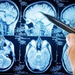 oamenii de stiinta descopera un circuit cerebral care poate opri durerea cronica 68ee6159756d4
