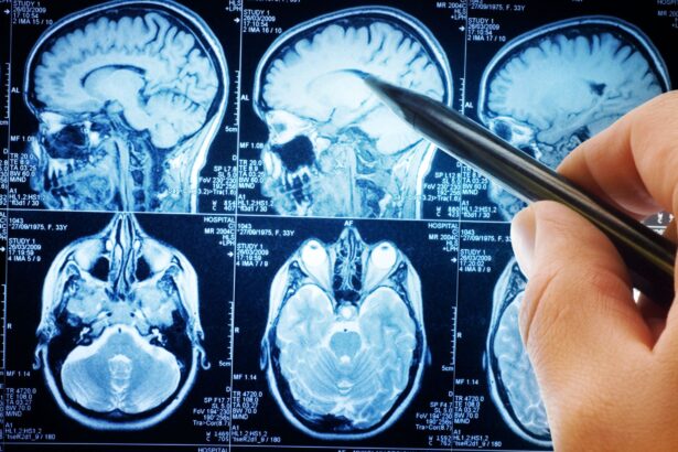 oamenii de stiinta descopera un circuit cerebral care poate opri durerea cronica 68ee6159756d4