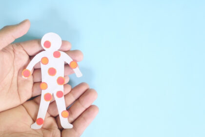 canada isi pierde statutul de tara fara rujeola sua sunt si ele aproape in aceeasi situatie 6912571e6cc3b