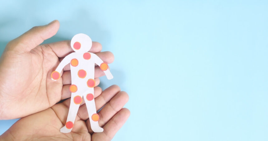 canada isi pierde statutul de tara fara rujeola sua sunt si ele aproape in aceeasi situatie 6912571e6cc3b