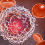 descoperire majora cercetatorii au reusit sa elimine complet leucemia in modele preclinice 690621c10ba2b