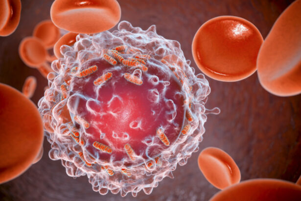 descoperire majora cercetatorii au reusit sa elimine complet leucemia in modele preclinice 690621c10ba2b