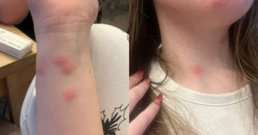 video o tanara a ajuns la spital dupa ce a fost muscata de plosnite intr un tren cfr familia a facut plangere 6922d24edcae0