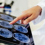 video premiera medicala la spitalul bagdasar arseni din bucuresti operatie pe creier cu pacientul treaz a fost foarte curajos 691c22288e66a